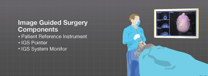 how-does-image-guided-surgery-work