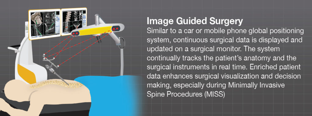 What Is Image Guided Surgery For Spine? - Brainlab.org